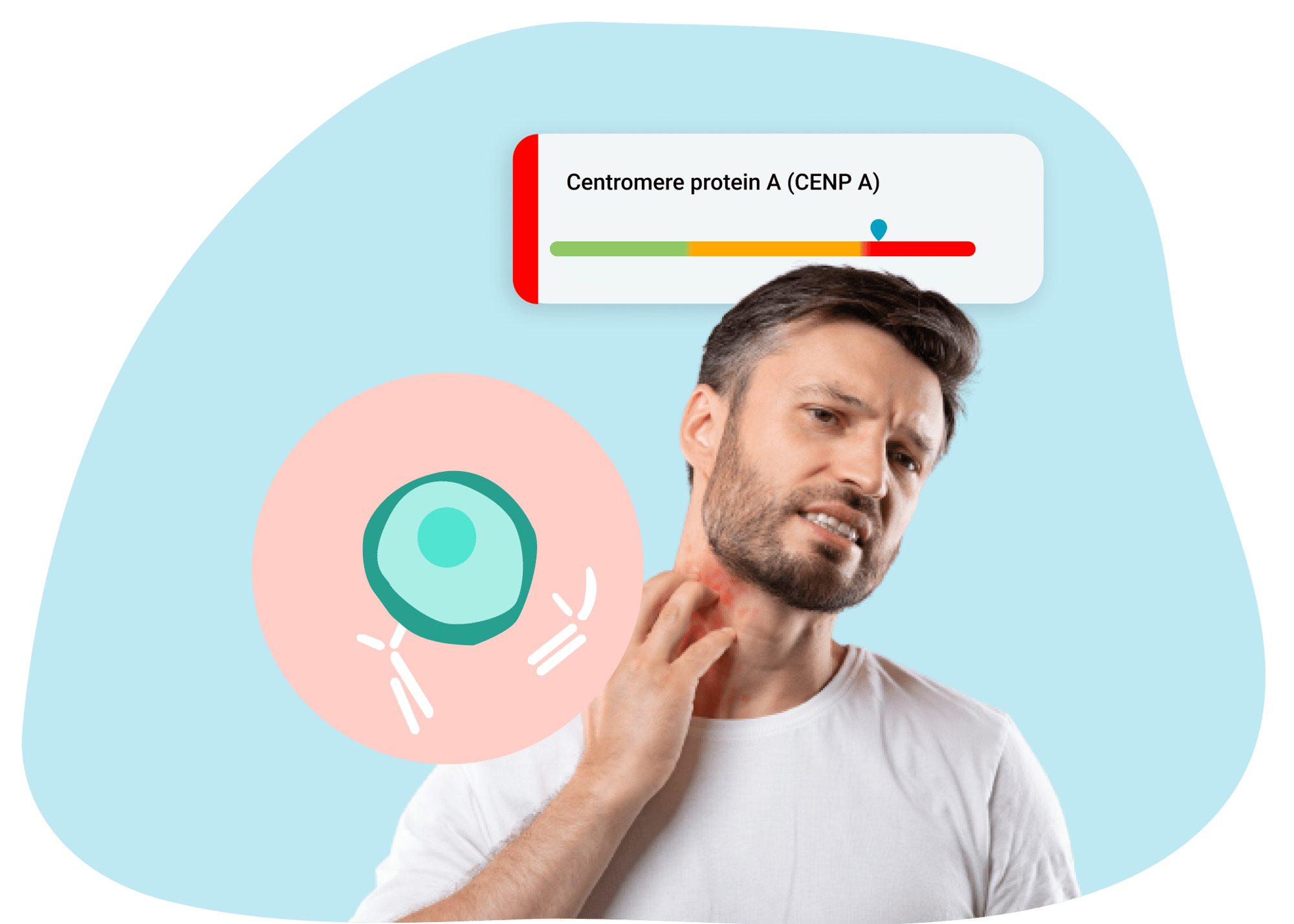 Autoimmune-Zoomer-Symptoms